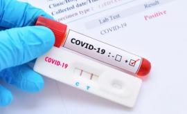 Ultima oră 1570 cazuri noi de coronavirus în R Moldova