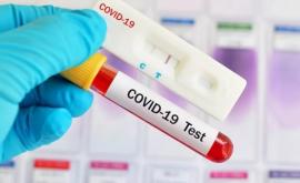 Ultima oră 1691 cazuri noi de coronavirus în R Moldova