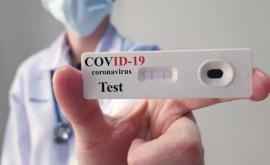 Ultima oră 808 cazuri noi de coronavirus în R Moldova