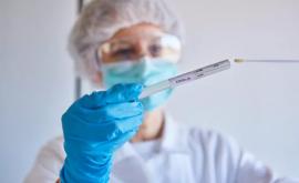 Laboratoarele din Moldova nu au capacitatea de a depista noua tulpină a Covid19