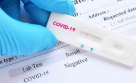377 cazuri de COVID19 înregistrate în ultimele 24 ore
