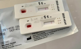 Moldova va primi 10 000 de teste Covid19 de la Slovacia