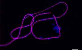 Oamenii de știință au creat un lanț electric din bacterii
