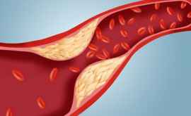 Ce trebuie să ştii despre colesterolul bun