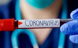 Alte 104 cazuri de coronavirus confirmate în Republica Moldova